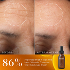 Medik8 C-Tetra Luxe - Face & Neck Serum